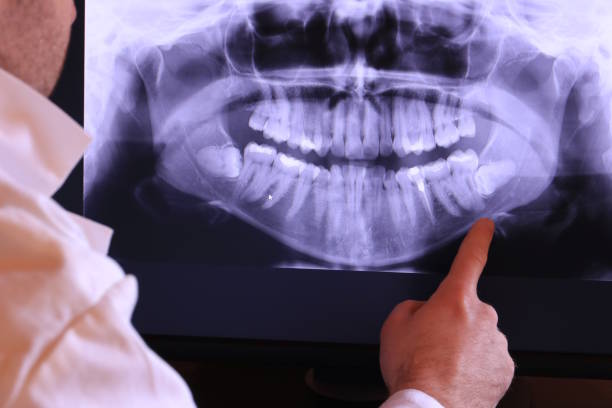 Best Emergency Dentist for Special Needs Patients in Somerset, TX