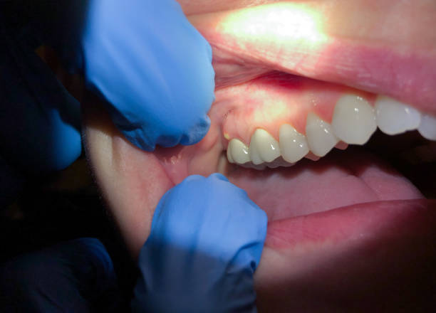Best Emergency Dental Services for Seniors in Somerset, TX