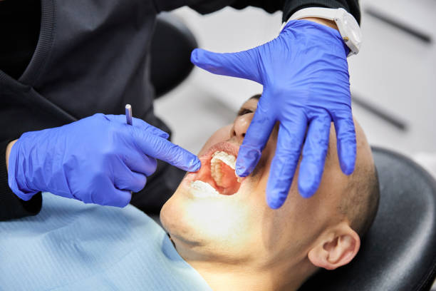 Best Emergency Dentist for Lost Fillings or Crowns in Somerset, TX