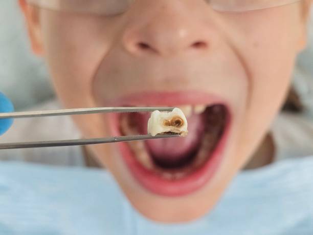 Best Orthodontic Emergency Dentist in Somerset, TX